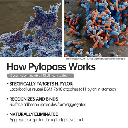 5-in-1 Advanced Pylopass H. Pylori Probiotic Support